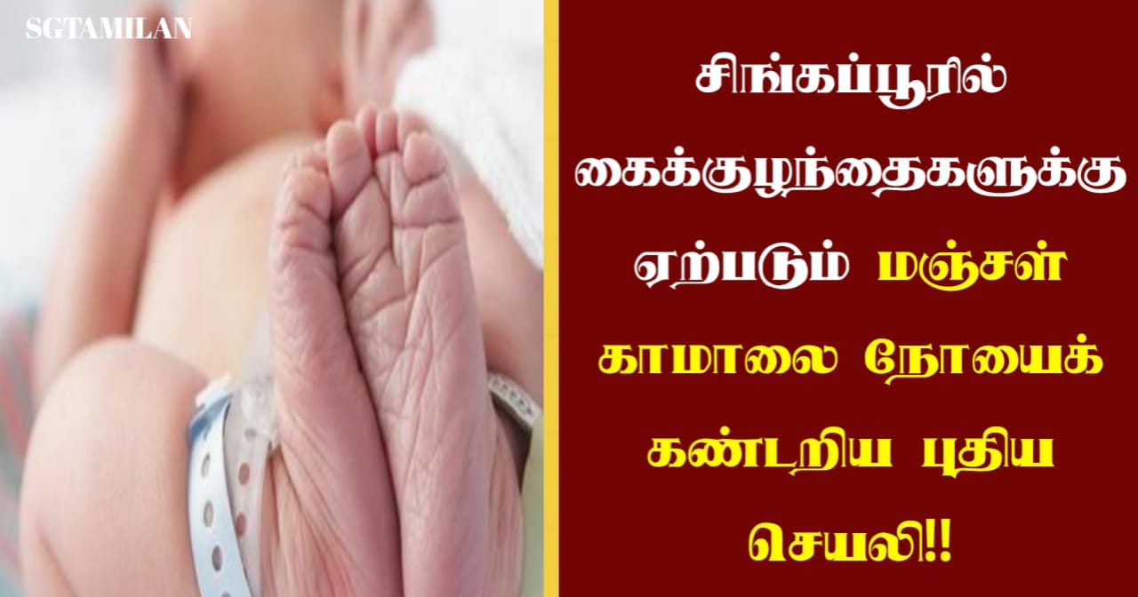 சிங்கப்பூரில் கைக்குழந்தைகளுக்கு ஏற்படும் மஞ்சள் காமாலை நோயைக் கண்டறிய புதிய செயலி!!