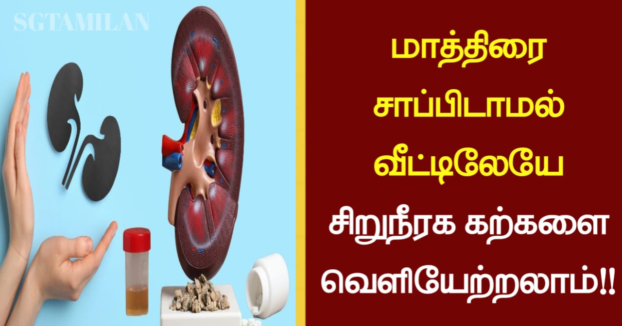மாத்திரை சாப்பிடாமல் வீட்டிலேயே சிறுநீரக கற்களை வெளியேற்றலாம்..!!!