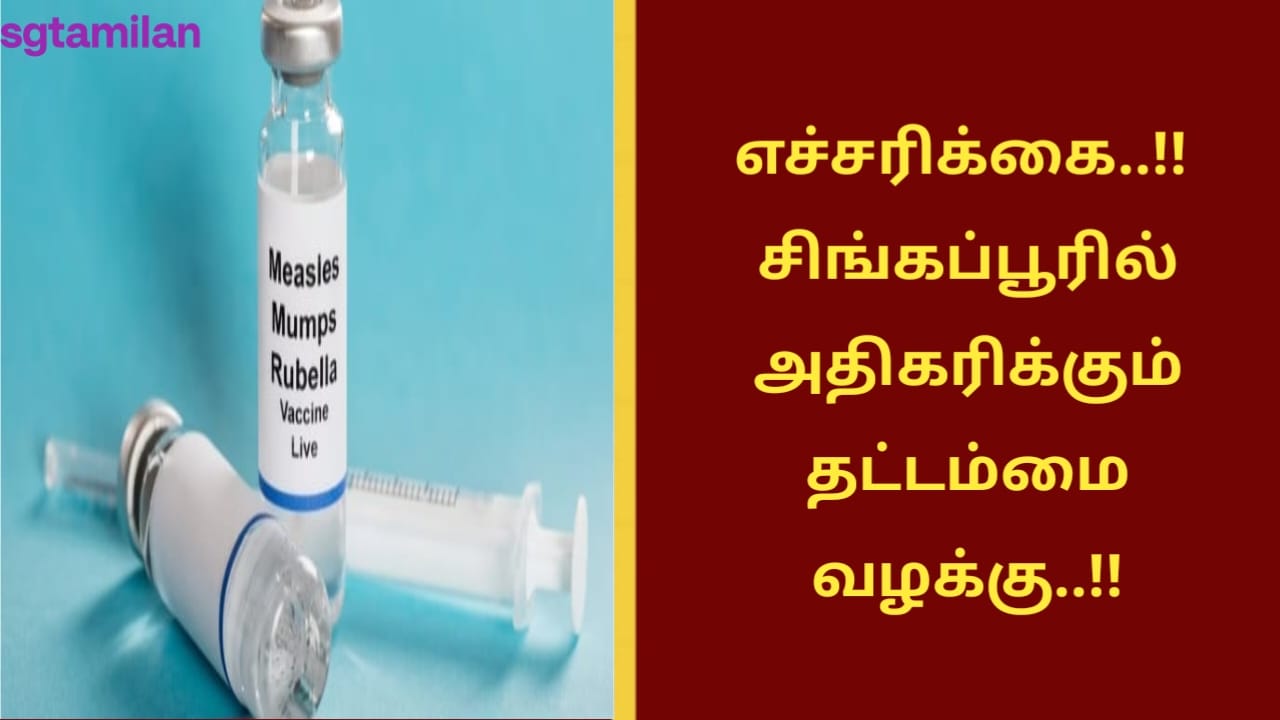 எச்சரிக்கை..!! சிங்கப்பூரில் அதிகரிக்கும் தட்டம்மை வழக்கு..!!