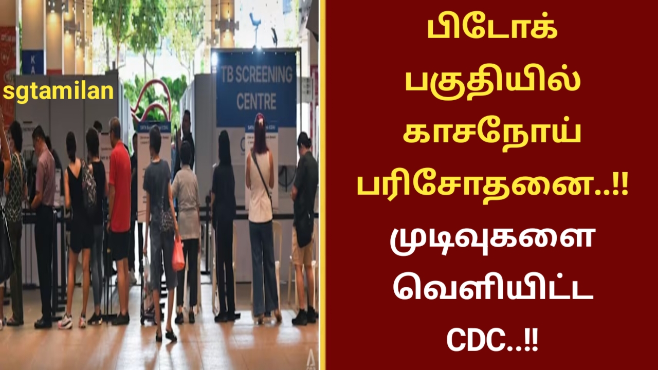 பிடோக் பகுதியில் காசநோய் பரிசோதனை..!! முடிவுகளை வெளியிட்ட CDC..!!