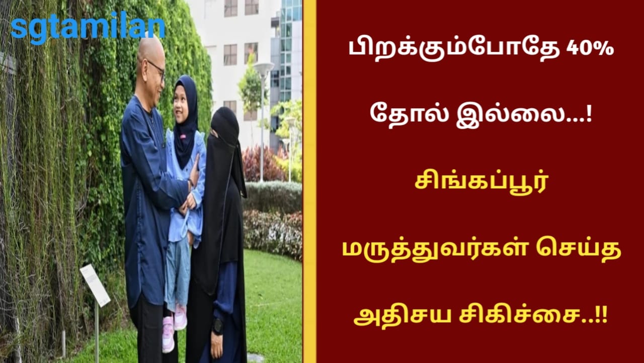 பிறக்கும்போதே 40% தோல் இல்லை…! சிங்கப்பூர் மருத்துவர்கள் செய்த அதிசய சிகிச்சை..!!